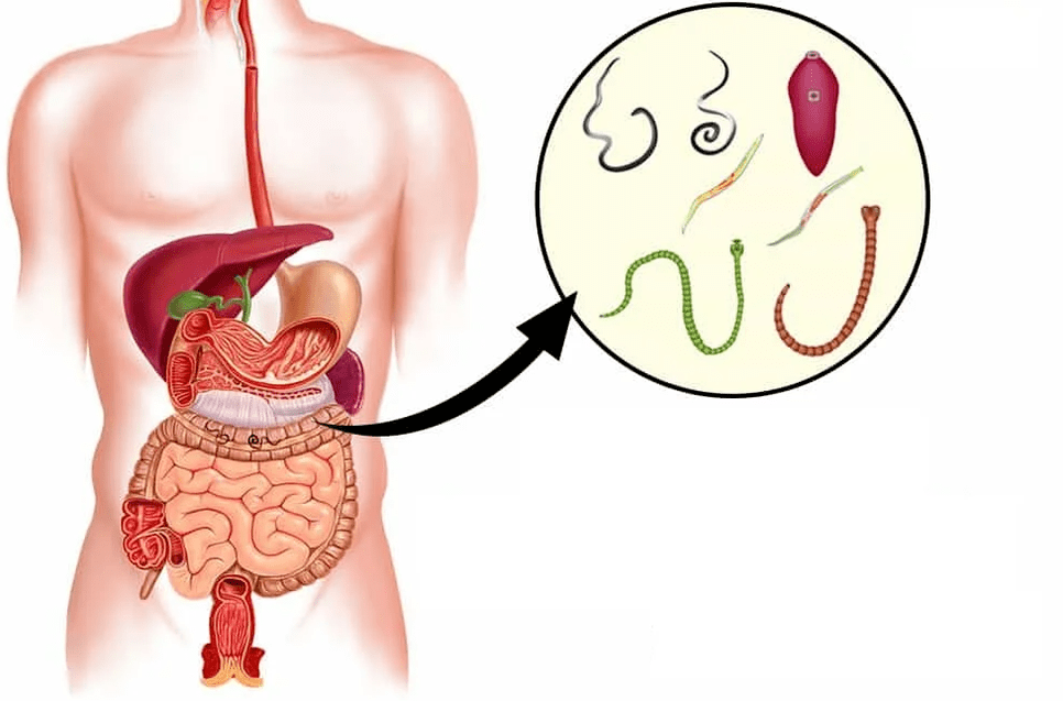 Elminti e vermi nel tratto gastrointestinale