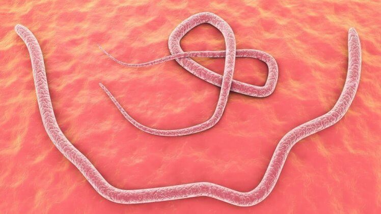 nematodi nel corpo umano