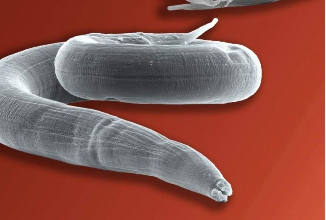 ossiuri dal corpo umano