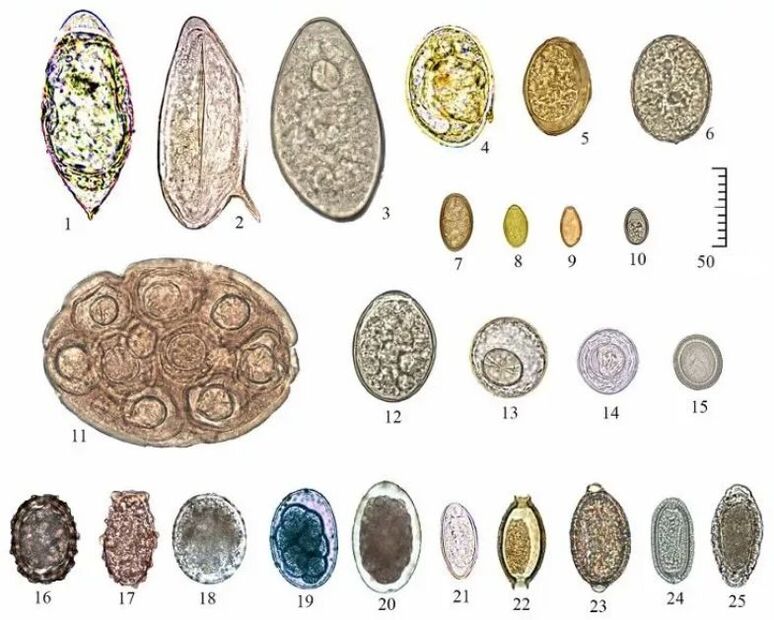 forma e dimensione delle uova di diversi elminti