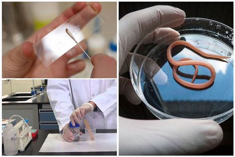 test per la presenza di vermi nel corpo