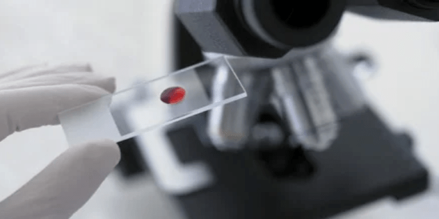 Analisi del sangue