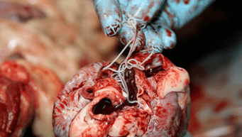 Elminti nel cuore