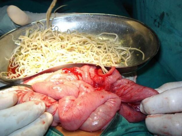 Parassiti intestinali