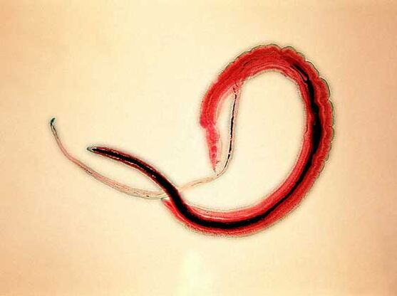 Trematodi di sangue